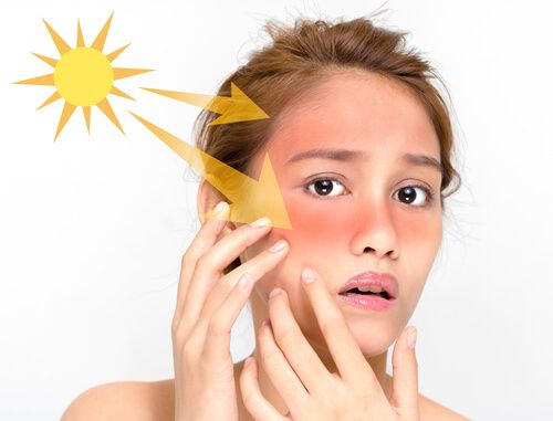 What Is the Fastest Way to Remove a Sun Tan