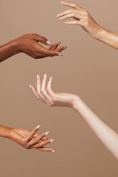 How Long Does Pigmentation Take to Fade With Treatment