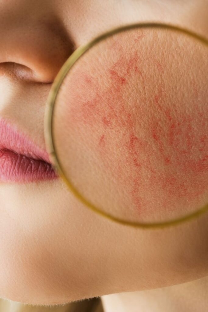 How to Know Your Skin Type at Home