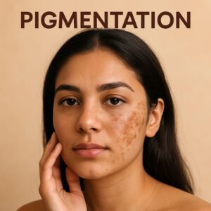 How Long Does Pigmentation Take to Fade